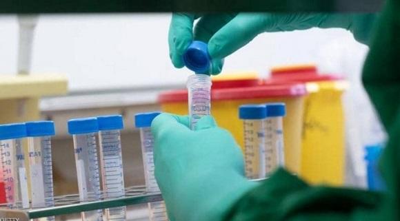 روسيا جاهزة لتوريد لقاح ضد كورونا