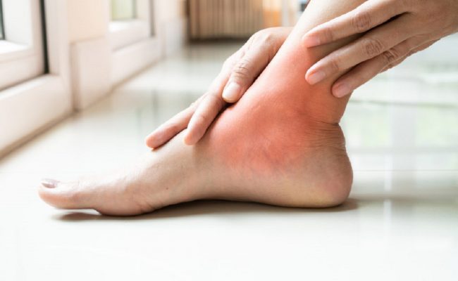 علاج القدم السكرية بالاعشاب