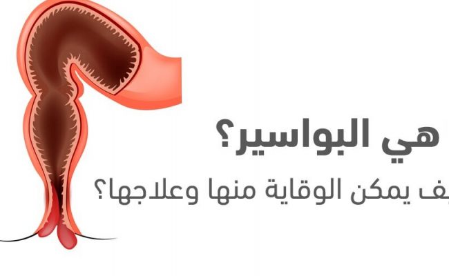 هل البواسير تسبب خروج دم مع البراز