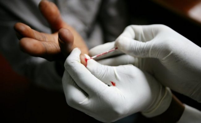 هل تحليل الدم الشامل يكشف الايدز