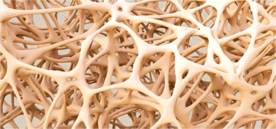 03724487943e07e17feca916f725f119-1 هشاشة العظام: متى يجب ان تُعالج؟