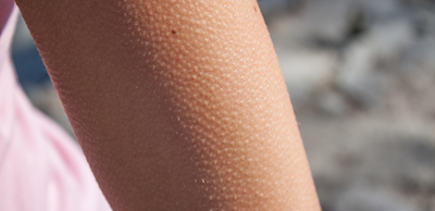 03bd4ff37784f510ab775c33583c6e79-1 التقرن الشعري