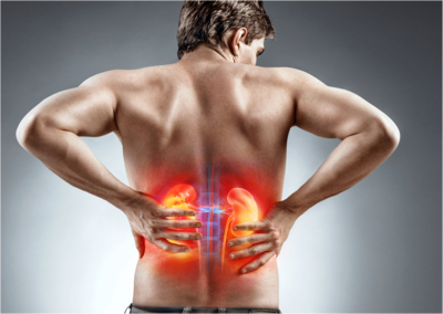 073a9d72618033828dbc92c45b7625ef-1 الحصى الكلوية، وما فعالية الأدوية في الوقاية من تشكلها