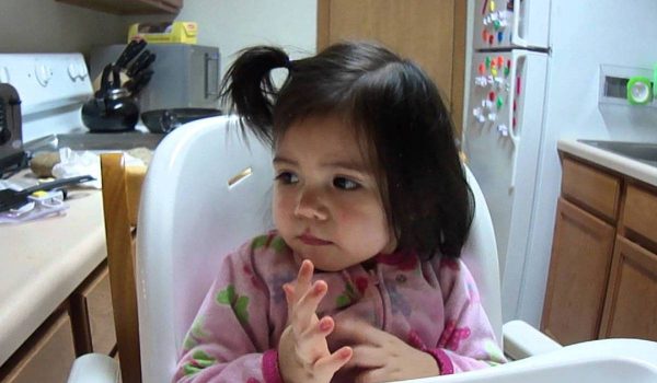 متلازمة ويست