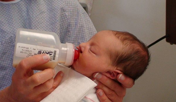 رضاعة الشفة الارنبية