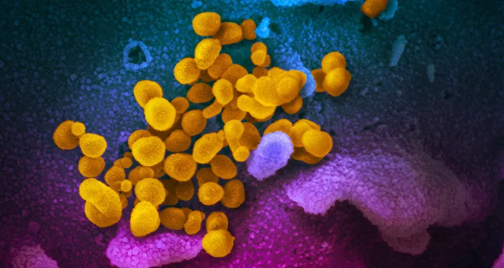 صورة مجهرية إلكترونية لعينة من مريض، لجزيئات فيروس SARS-COV-2 (باللون الأصفر)، والمعروفة أيضًا باسم الفيروس التاجي الجديد كورونا، الفيروس الذي يسبب مرض Covid-19.