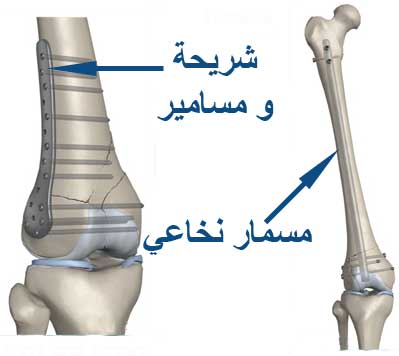 عظم
