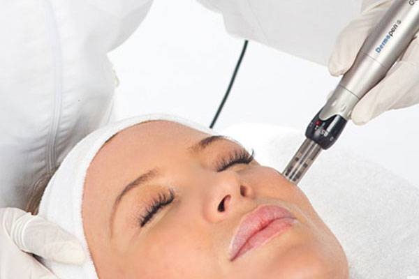 الديرما رولر