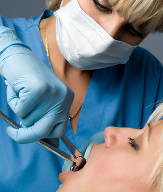 خلع الاسنان خلع الاسنان