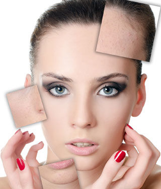 الصوم يقلل من الأمراض الجلدية الصوم يقلل من الأمراض الجلدية