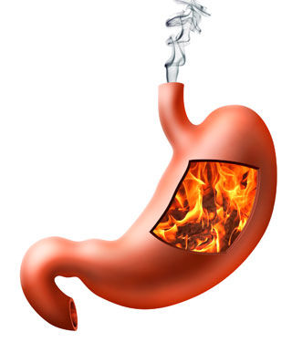 تقليل الحرقة تقليل الحرقة