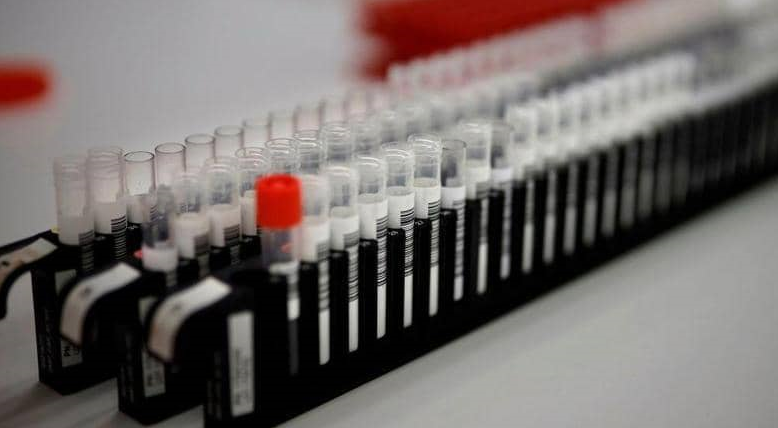 1500x9999-c-20 تطوير مادة معقمة تحمي بشدة من عدوى كورونا