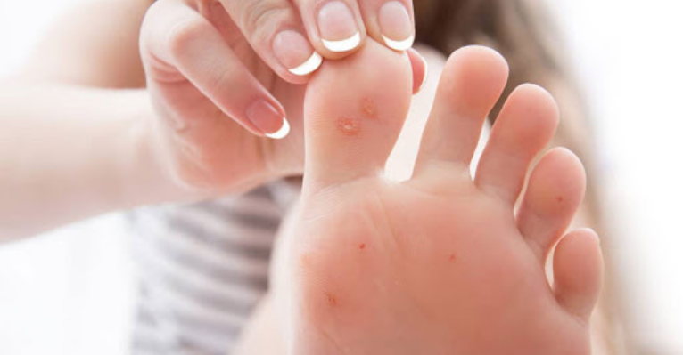 1500x9999-c خبراء يكشفون عن أعراض جديدة غريبة للإصابة بفيروس كورونا