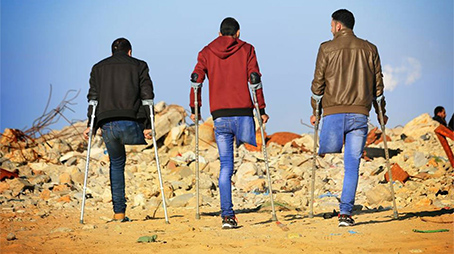 مبتورو الأطراف في غزة.. معاناة يفاقمها الحصار