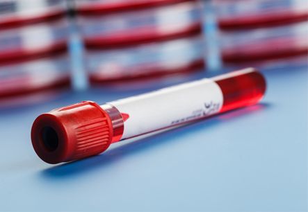 1depositphotos_32806701_m تشخيص الامراض المعدية