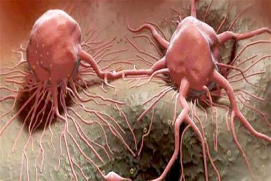 علماء يحددون السبب وراء ارتفاع أعداد المصابين بالسرطان