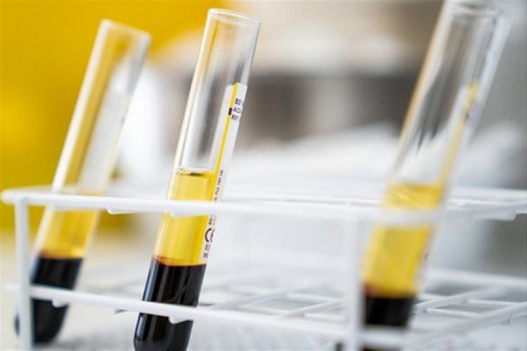 "الصحة" تجري تجارب على بلازما المتعافين لاستخدامها في علاج كورونا