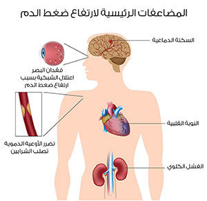 مضاعفات ضغط الدم مضاعفات ارتفاع ضغط الدم