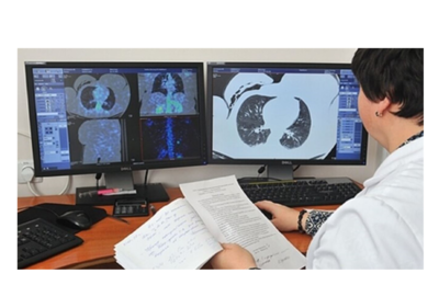 26bf1c9b6066a180456f5ff3f333e6d9-1 أعراض السرطان