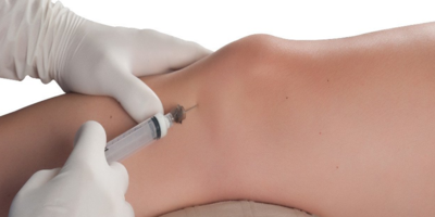 51d53b9d682743eb1bf0acae99f0f2b9-1 حقن البوتوكس في علاج تشنج (شد) العضلات عند الأطفال