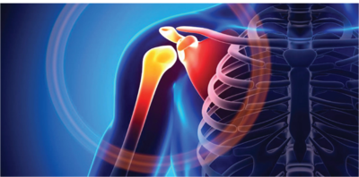 5232b9277fc1e8e705cf063bb71afce1-1 خلع مفصل الكتف بين الأنواع و طرق العلاج