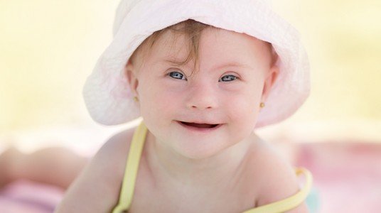 54a8fd567b8daarticle_2700_1-1 متلازمة تورنر