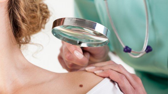 54bb66e4d6843article__1-1 متى يجب أن أقلق من الشامة!