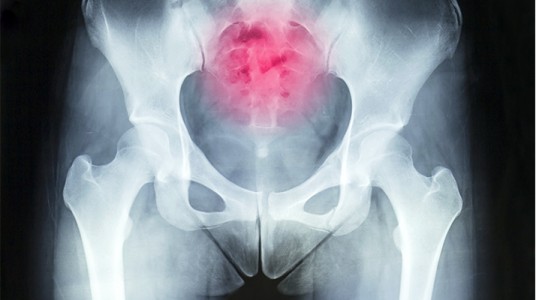 54ca31adcfd49article__1-1 آلام العصعص وكيفية التغلب عليها