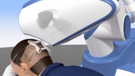 56406bd4a377darticle_3233_1-1 زراعة الشعر باستخدام الروبوت