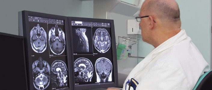 56e13cb095a25article_2603_1-1 علاج مرض التصلب العصبي المتعدد