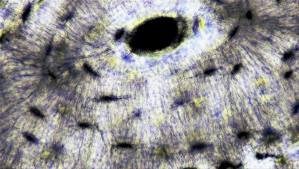 تحاكي الجسم البشري.. مادة ذكية قادرة على دعم نفسها ذاتيا العظام تستخدم إشارات الخلايا للتحكم في إضافة أو إزالة المعادن المأخوذة من الدم (ويكيميديا كومونز)