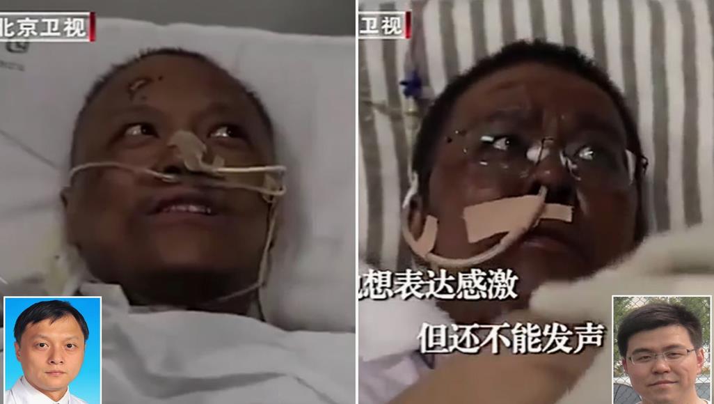 أعراض لم تكن معروفة.. فيروس كورونا يغير لون جلد ناجيين ويؤثر على الدماغ فيروس كورونا يؤثر على الكبد مما قد يؤدي لتغير لون الجلد (محطة تلفزيون بكين)