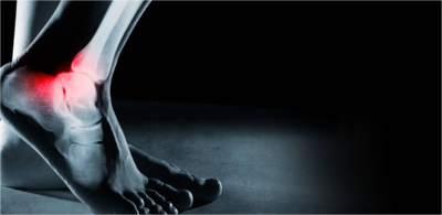 5acde49424f0cda7eb97aaf43b8f1dd7-1 معلومات حول التواء مفصل الكاحل