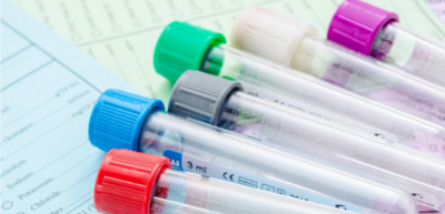 5ec3ce6efc048d14684862fd7f4810c0-1 الأدوية والمكملات الغذائية المؤثرة على نتائج التحاليل المخبرية