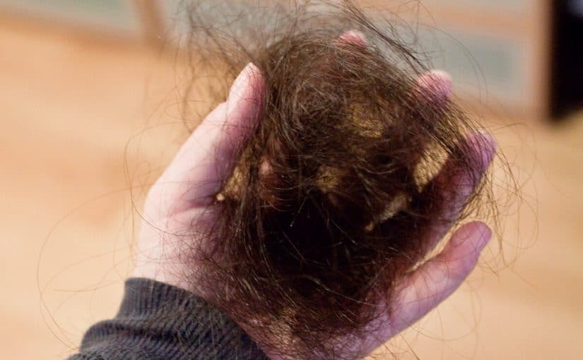 6ea9f851-6a0f-4f88-bb77-ccaa0dc40ae8-825x510-2 اسباب سقوط الشعر