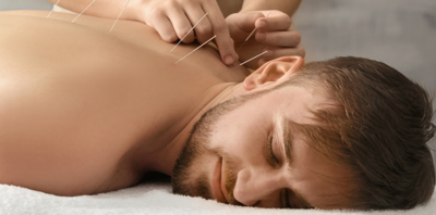 7a835a93be3c9bad438cda3759e2c6e9-1 الوخز بالإبر لتعزيز الدافع الجنسي