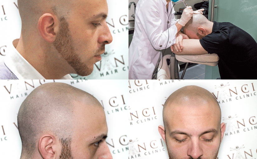 مركز لحل مشاكل الشعر في الرياض