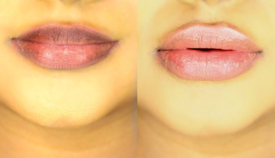 924eecc87df7f782378e5a52febc9b7a-1 تفتيح الشفايف