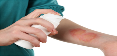 993297d30f8057bb6057c04e0138392c-1 عمليات تجميل الحروق