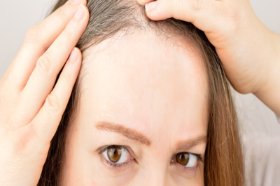 9fdd517c681aee865793243108982971-1 ما هي أسباب الشيب المبكر؟