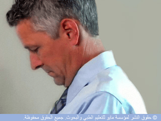تمديد الذقن تمديد الذقن