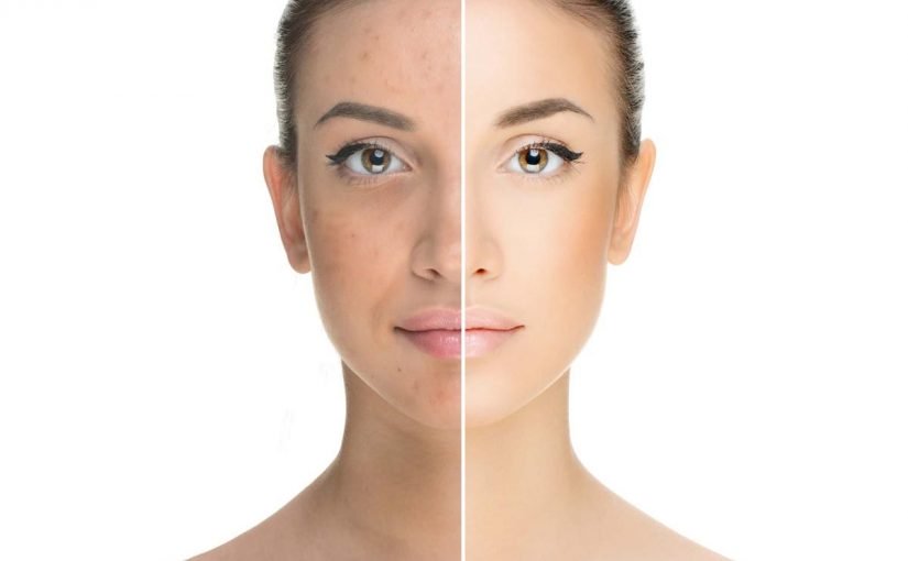 akmi2-1200x800-825x510-2 كريم تفتيح