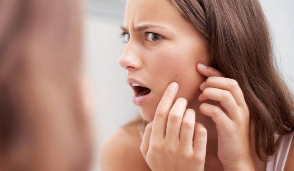 اسباب ظهور حبوب في الوجه قبل الدوره