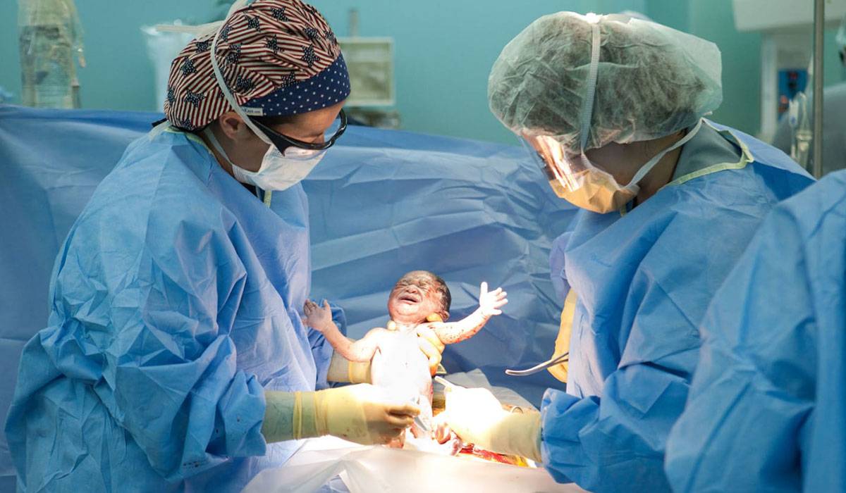 شرب الجنين ماء البطن اثناء الولادة