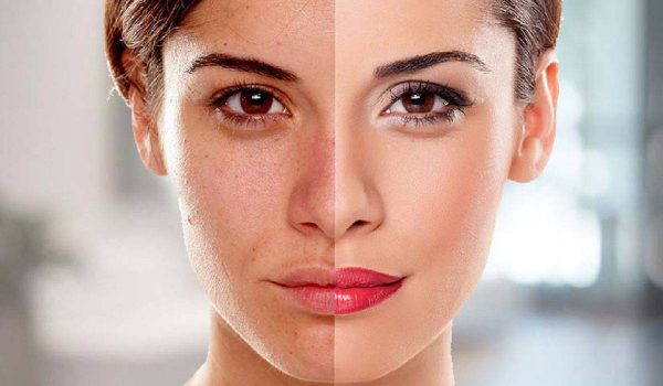 article-61-3 كيفية تبييض الوجه