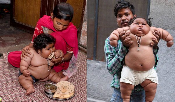 بدانة الاطفال