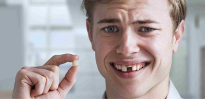 b0524674cb740011dc951e406d6a4270-1 سقوط الأسنان