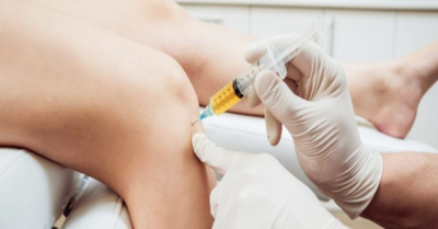 bef8983a8628d71dc77af7b1a197197a-1 حقن البلازما لآلام المفاصل