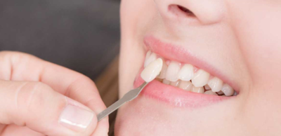 c4b605036d625c95f5ff699a7345b4eb-1 الفرق بين القشور الخزفية والزريكون