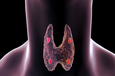 c50c2260173f2fff4e5aebb3fcb091a9-1 الغدد جارة الدرقية والأمراض التي يمكن أن تصيبها